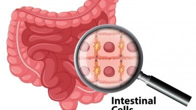 Serene Naturopathic Clinic Toronto : Schedule with an ND Today! Struggling with digestive issues? Uncover the root cause with SIBO (Small Intestinal Bacterial Overgrowth) info & natural solutions. Get lasting relief & reclaim your gut health!