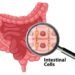 Serene Naturopathic Clinic Toronto : Schedule with an ND Today! Struggling with digestive issues? Uncover the root cause with SIBO (Small Intestinal Bacterial Overgrowth) info & natural solutions. Get lasting relief & reclaim your gut health!