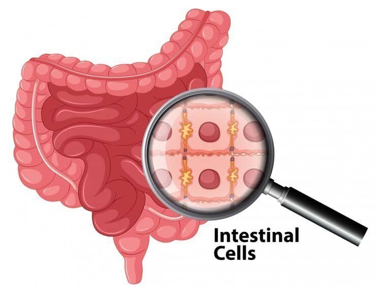 Understanding SIBO: A Naturopathic Perspective