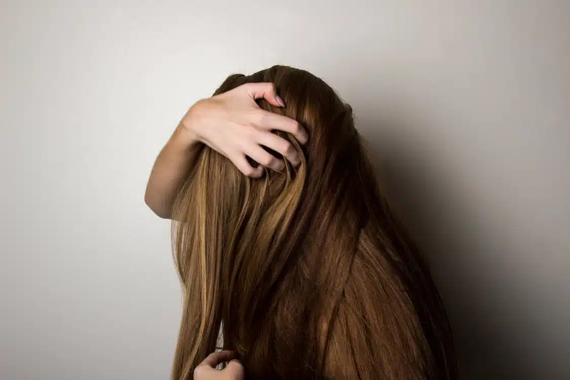 Natural Hair Loss Solutions for Women | Naturopathic Clinics Toronto