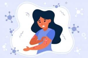 Holistic Doctor Toronto for eczema: Eczema, also known as atopic dermatitis, is a chronic inflammatory skin condition that leads to dry, itchy patches on the skin. It often appears on the face, arms, legs, and the back of the knees, though it can occur anywhere on the body. At Serene Clinic, we are committed to helping you heal naturally and supporting your health journey every step of the way.