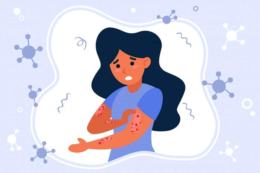Holistic Doctor Toronto: Natural Eczema Relief