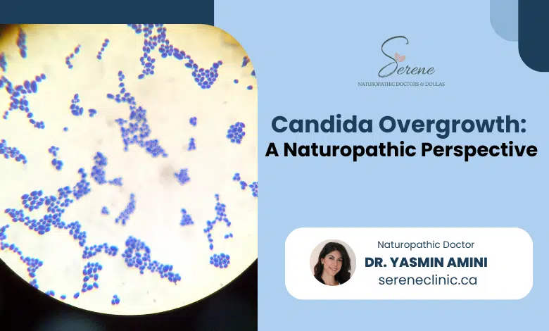 Candida Overgrowth: A Naturopathic Perspective